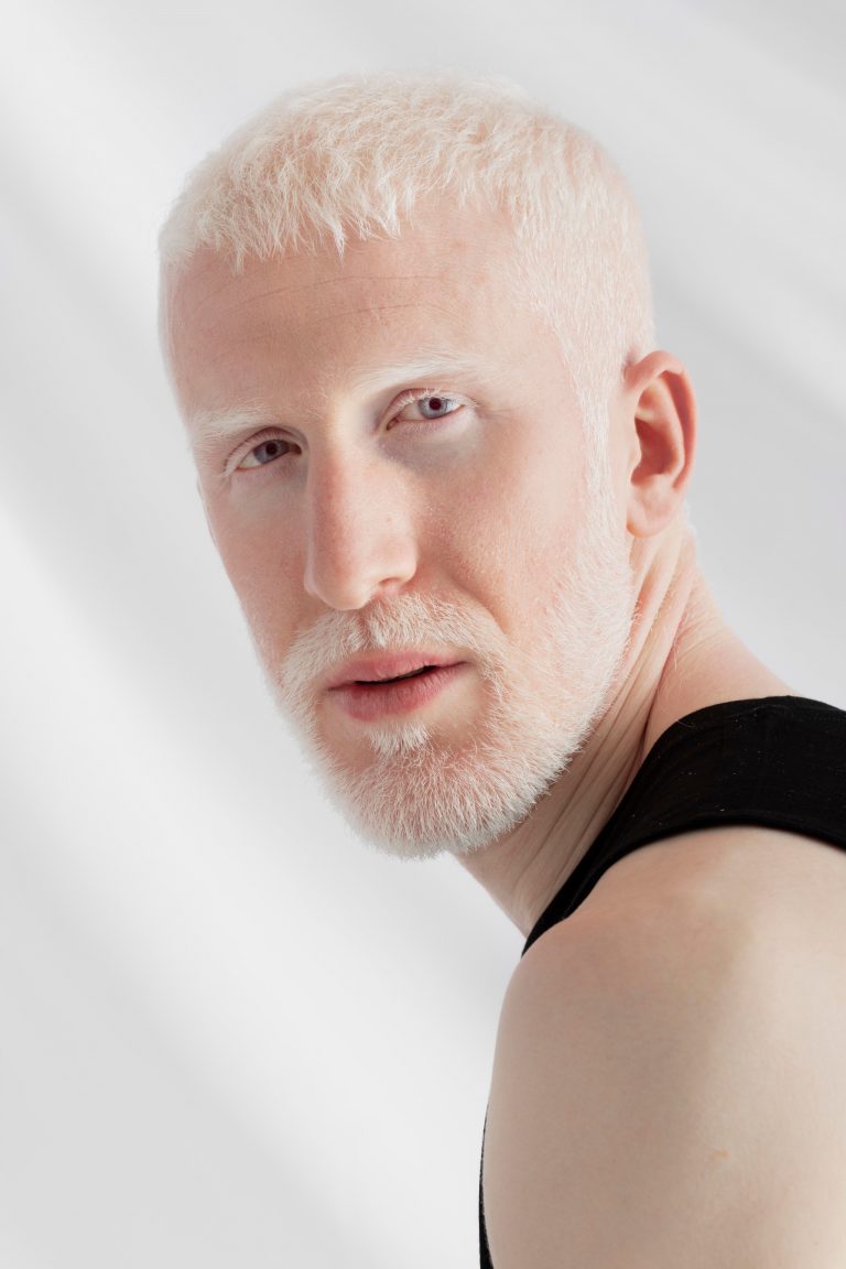 handsome-albino-man-posing-2028x3072